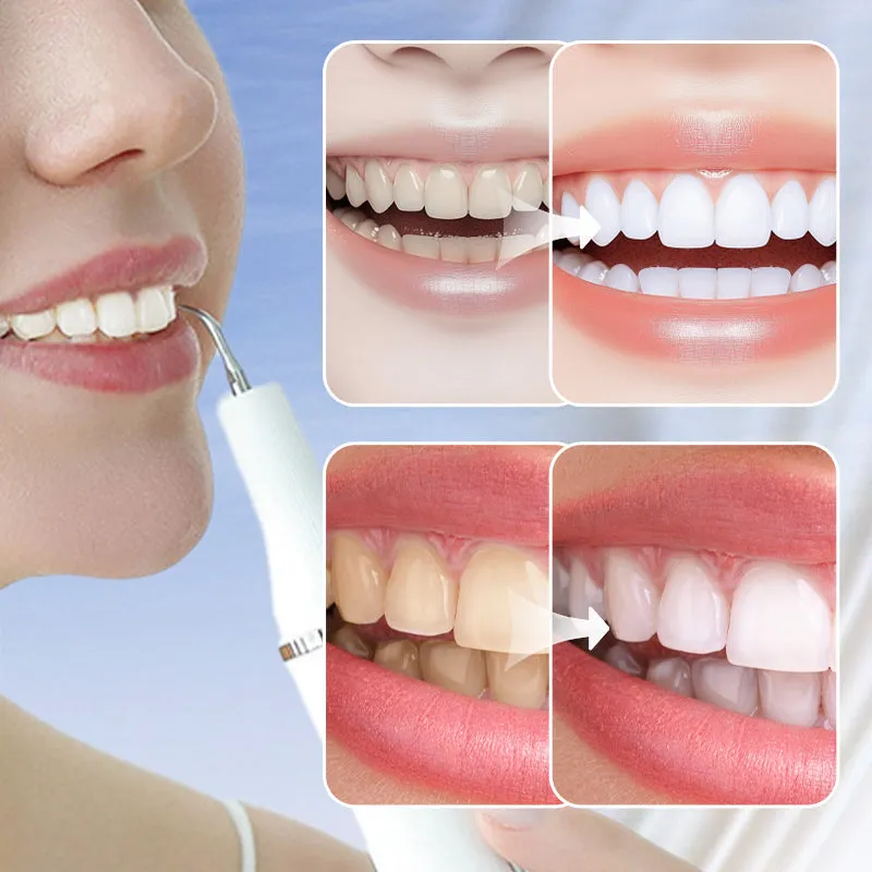 50%OFF Christmas SaleUltrasonic Flosser for Whitening & Tartar Removal